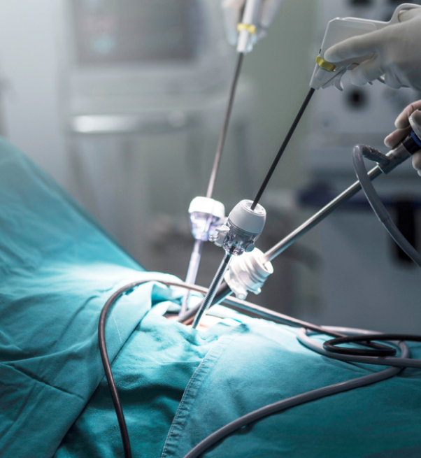Advanced Laparoscopic Gynaecological Specialty Surgeries