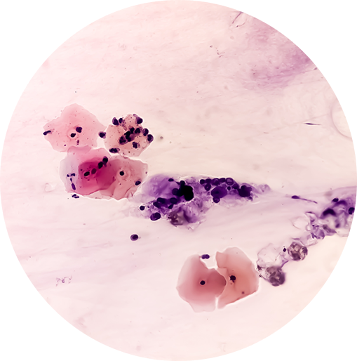 What is a cervical screening test?